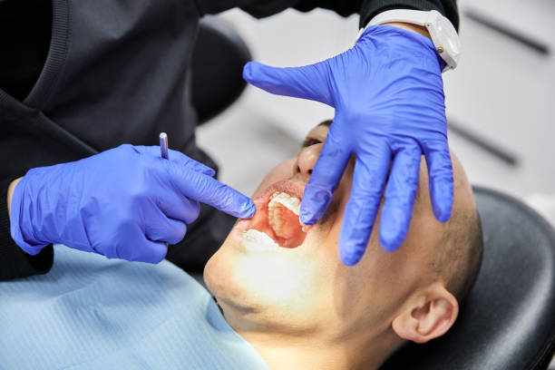 Best Broken or Cracked Tooth Emergency Dentist in Bellefonte, PA